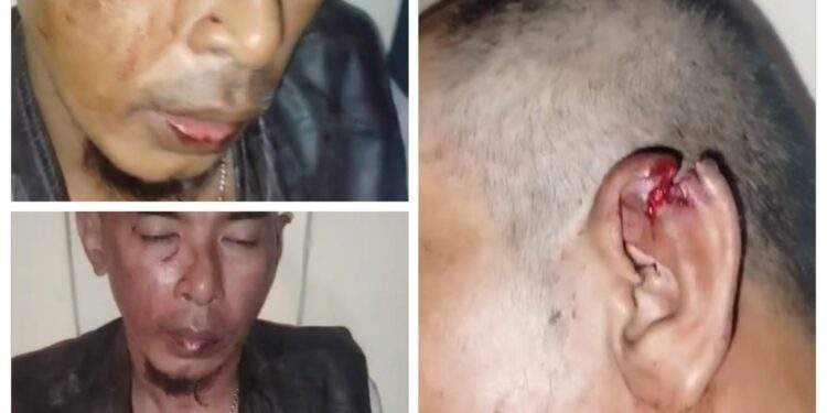 Viral Subang Zona Merah, Marak Premanisme Persekusi Jurnalis